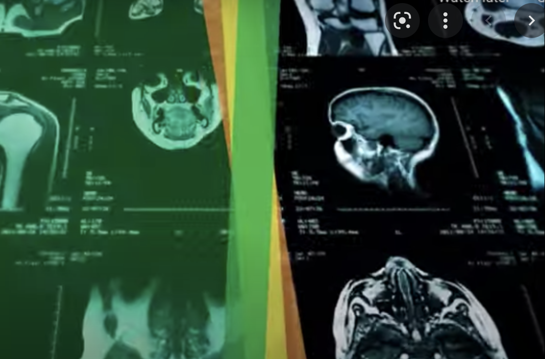 Median Technologies Is Moving Forward With the FDA Interactions